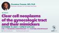 Oluwole Fadare - Clear cell neoplasms of the gynecologic tract and their mimickers-Fadare October.jpg